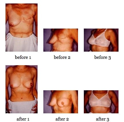 breast reconstruction surgery before and after