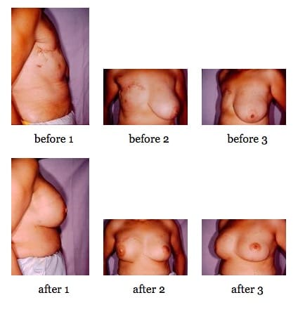 breast reconstruction surgery before and after