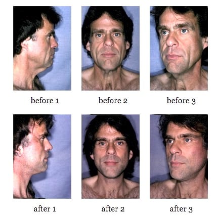 Male Facelift Before and After